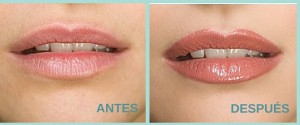 ANTES (4)