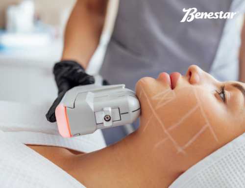 HIFU Facial y RADIOFRECUENCIA  Facial en Barcelona: el TRATAMIENTO  combinado más eficaz para reafirmar y rejuvenecer la piel