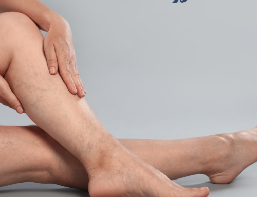 Recupera la ligereza de tus piernas