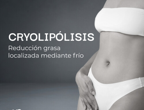 Cryolipolisis en Barcelona para grasa localizada | Benestar