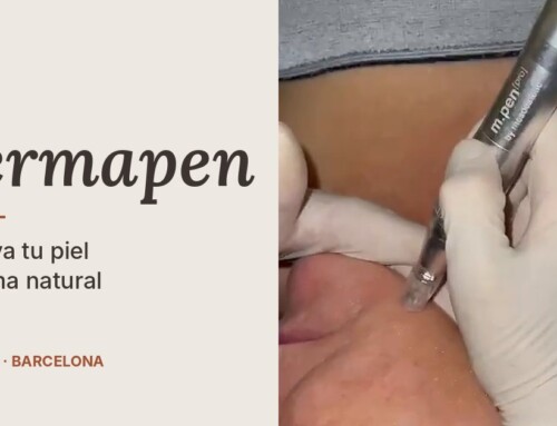 Dermapen en Barcelona: qué es, cómo actúa y para quién está indicado
